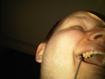 Adjusting my dental implant