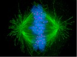 Force cancer cells to commit suicide… with electricity!